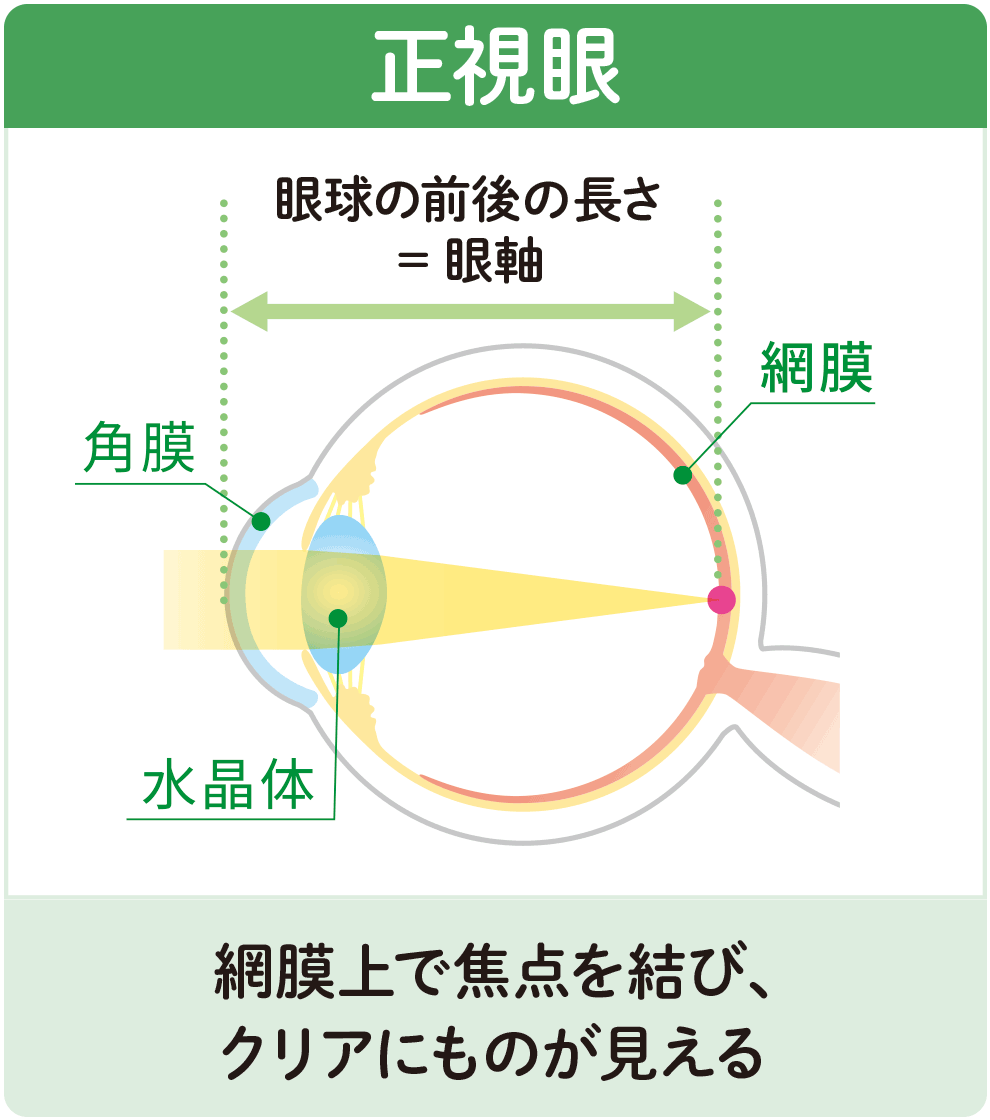 正視眼